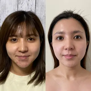 小顔美肌エステサロン パステル・岡本直子のエステ・リラクイメージ