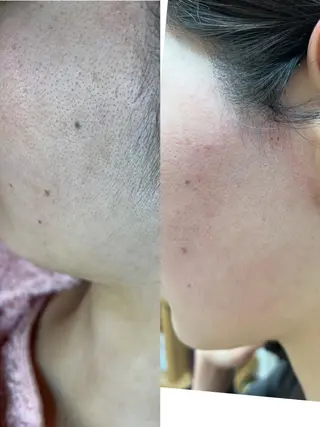 うえつま ふみえのエステ・リラクイメージ