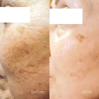 韓国肌管理・肌質改善 EARNEST心斎橋のエステ・リラクイメージ