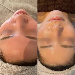 小顔×痩身専門サロンCLORE浦和店所属・石川 彩花のエステ・リラクイメージ