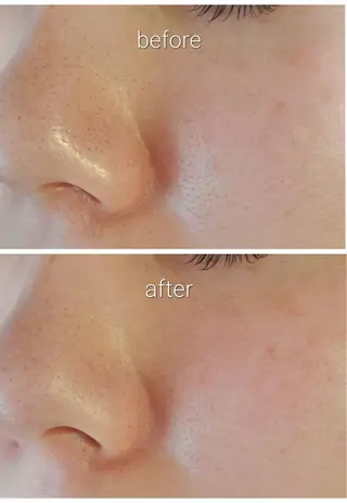 サロンur（ユア） Rieのエステ・リラクイメージ