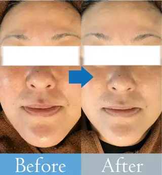 美肌/小顔/眉毛の 専門店 ルミナスのエステ・リラクイメージ