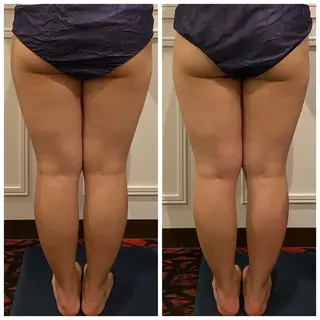 ハイパーナイフEX 小顔×痩身ケアのエステ・リラクイメージ