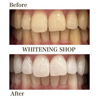 ホワイトニングショップ伊丹店所属・ホワイトニング ショップ伊丹店のその他イメージ