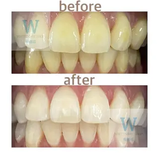 ホワイトニング ショップ船橋店🦷のエステ・リラクイメージ