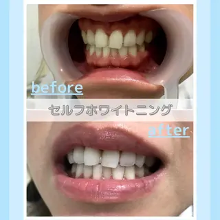 メンズ お手軽ホワイトニングsalon mina所属・武元 奈津美のその他イメージ