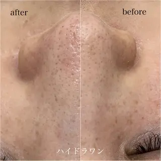 マツエク・マツパ omii salon 草津店:yurinaのマツエク・マツパデザイン