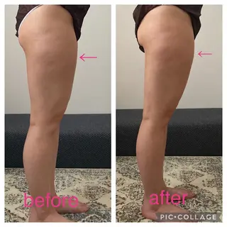 深層リンパドレナージュ ＆産前産後マッサージサロンShe所属・リンパドレナージュ＆ 産前産後サロンSheのエステ・リラクイメージ