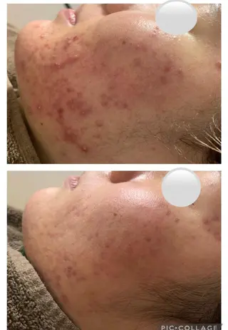 ミディアム カラー パーマ ヘアアレンジ メンズ キッズ ネイル マツエク・マツパ アイブロウ 肌質体質を変えて すっぴん肌にのエステ・リラクイメージ