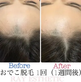 ネイル マツエク・マツパ レイフィールド江南店所属・レイエステティック 江南店のエステ・リラクイメージ