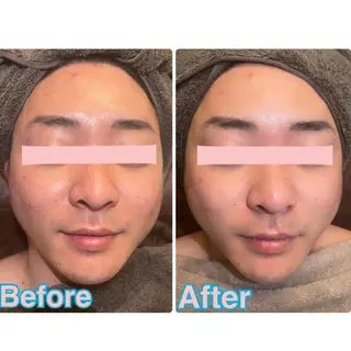 Beauty  Salon Twinkle所属・渡部 奈桜のエステ・リラクイメージ