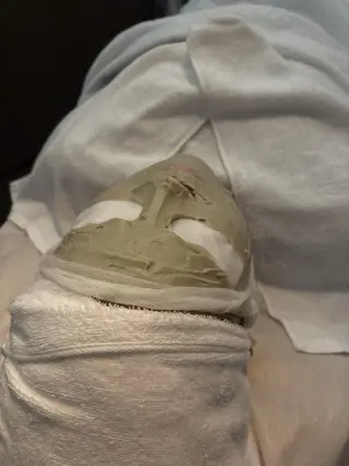 NARIS BEAUTY STATION　デ・アイム あべのルシアス所属・ニキビ跡/毛穴/ 肌質改善/北村ももこのエステ・リラクイメージ