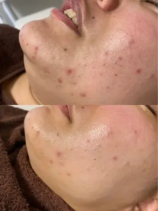 Kazrina 平松一美のエステ・リラクイメージ