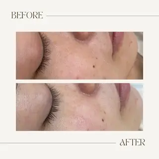 CEsalonEgg 齋藤のエステ・リラクイメージ