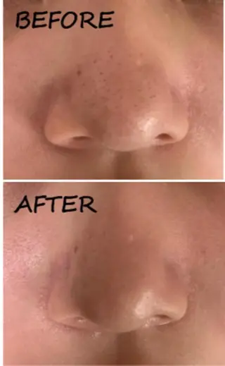 ヴィーナス ビューティーのエステ・リラクイメージ