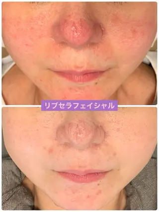 Private Salon Prunelle所属・プライベートサロン プリュネルのエステ・リラクイメージ