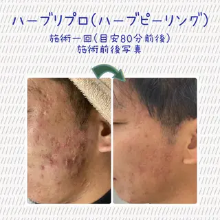 Laplace池袋本店(ラプラス池袋本店)所属・Laplace 池袋本店のその他イメージ