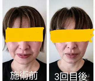 小顔矯正夙川 カレーズのエステ・リラクイメージ