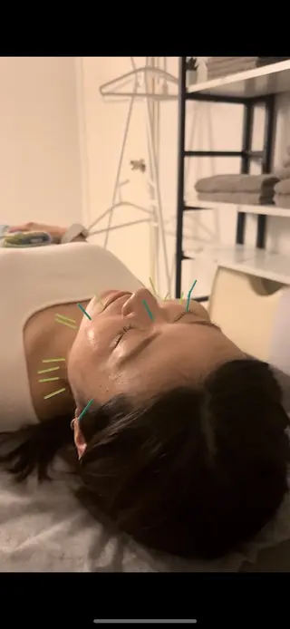 美容鍼×小顔矯正 ×美容整体　浜川泰仁のエステ・リラクイメージ