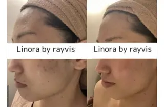 🌈Linora byRAYVIS🌈のエステ・リラクイメージ