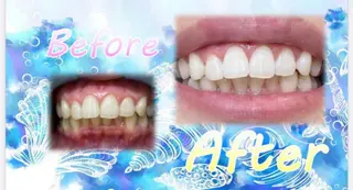 セルフホワイトニングサロン　ラヴィアン所属・ホワイトニングサロン La vie enのその他イメージ