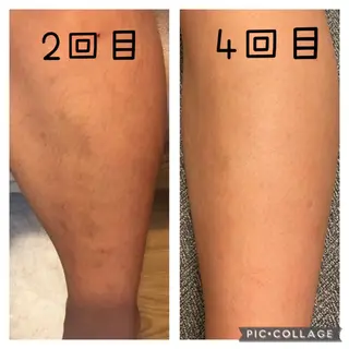 POPOのエステ所属・popoのエステ arisaのエステ・リラクイメージ