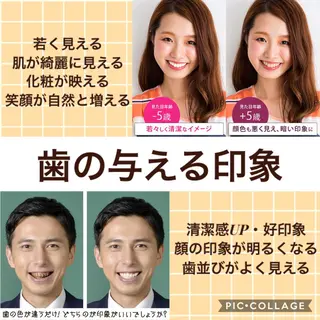 ホワイトニングバー 新潟店のその他イメージ