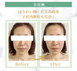 美容鍼灸師 齋藤 麗子のエステ・リラクイメージ