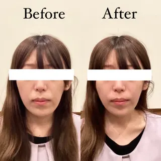 Hari Lounge恵比寿所属・chika🦋 ハリラウンジ恵比寿のエステ・リラクイメージ