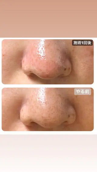 i'llbe  イルビー 脱毛・エステサロン所属・i'llbe イルビーのエステ・リラクイメージ