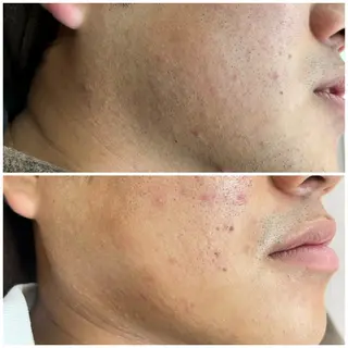 メンズ エステサロンMee. 大畑のエステ・リラクイメージ