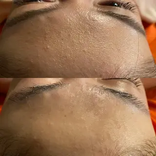 Mandarin Orange所属・毛穴から始める肌メン テマンダリンオレンジのエステ・リラクイメージ