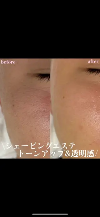 女性専門お顔剃り sunraineのエステ・リラクイメージ