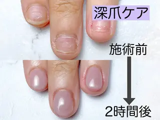 ネイル プライベートサロン Rのネイルデザイン
