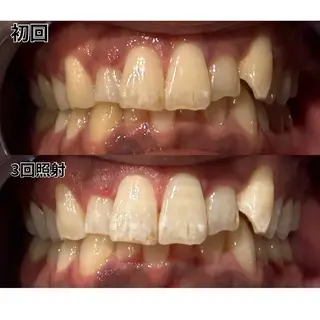 セルフホワイトニング　アデル所属・戸嶋 菫のエステ・リラクイメージ