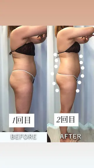 美容整体・塗る漢方・フェイシャルRechica所属・心斎橋痩身 美肌整体サロン💓のエステ・リラクイメージ