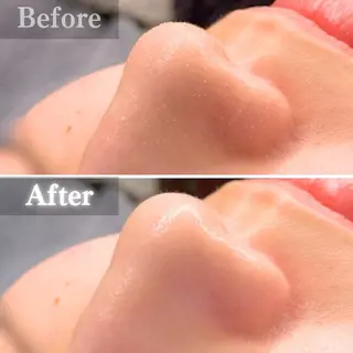 毛穴洗浄特化🫧 オオツカのエステ・リラクイメージ