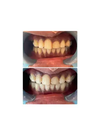 Lunenail所属・Lune nailのネイルデザイン