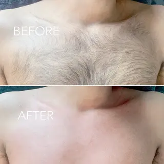 メンズ TREE WAX脱毛のエステ・リラクイメージ