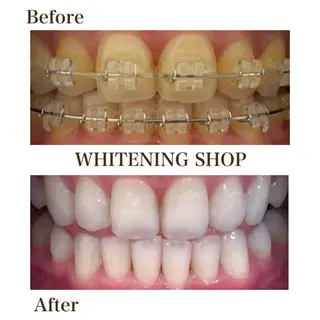 メンズ ホワイトニングショップ静岡葵区店所属・ホワイトニング ショップ葵区静岡駅店のその他イメージ