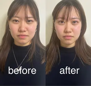 美容鍼灸サロン mahoroba院長のエステ・リラクイメージ