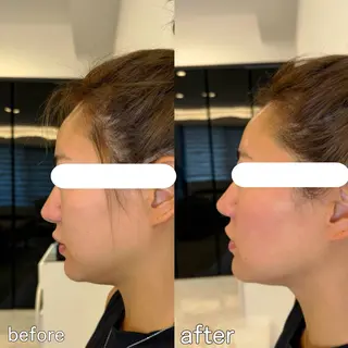 小顔矯正&美容整体 整え屋REDオーナーのエステ・リラクイメージ