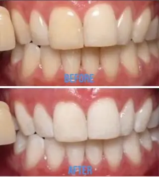 Venus Beauty銀座のマツエク・マツパデザイン