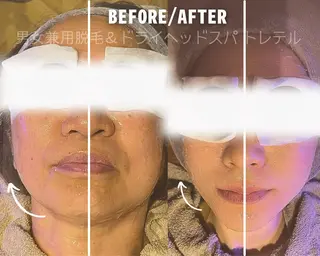 男女兼用脱毛&ドライ ヘッドスパ トレテルのエステ・リラクイメージ