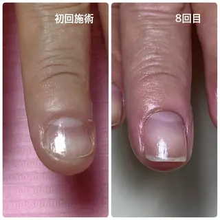 Nail ビ爪のネイルデザイン
