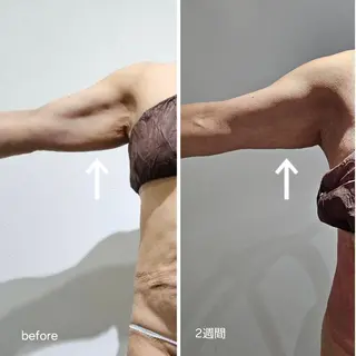 脂肪冷却 & 脱毛 AYUMIのその他イメージ