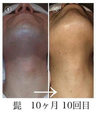 脱毛・眉毛・フェイス サロンN久留米店の眉毛・アイブロウイメージ