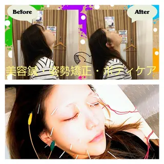 むくみたるみ専門☆ 美容鍼・小顔矯正のエステ・リラクイメージ