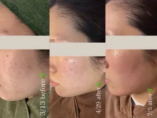 韓国肌管理Belle赤羽所属・韓国肌管理Belle 赤羽のエステ・リラクイメージ