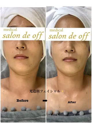 🩵Tatsumi Kana🩵のエステ・リラクイメージ